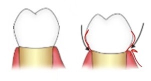 Example of an over-contoured town